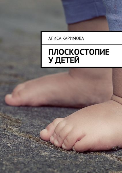 Плоскостопие у детей