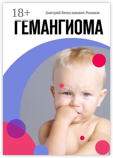 Гемангиома